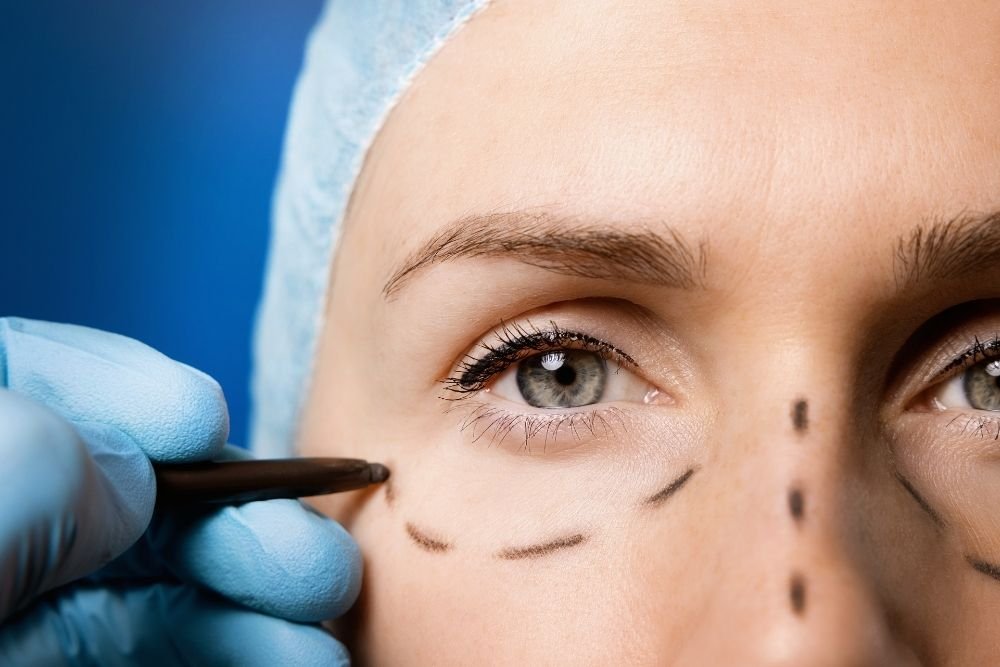 Is Eyelid Surgery Risky?