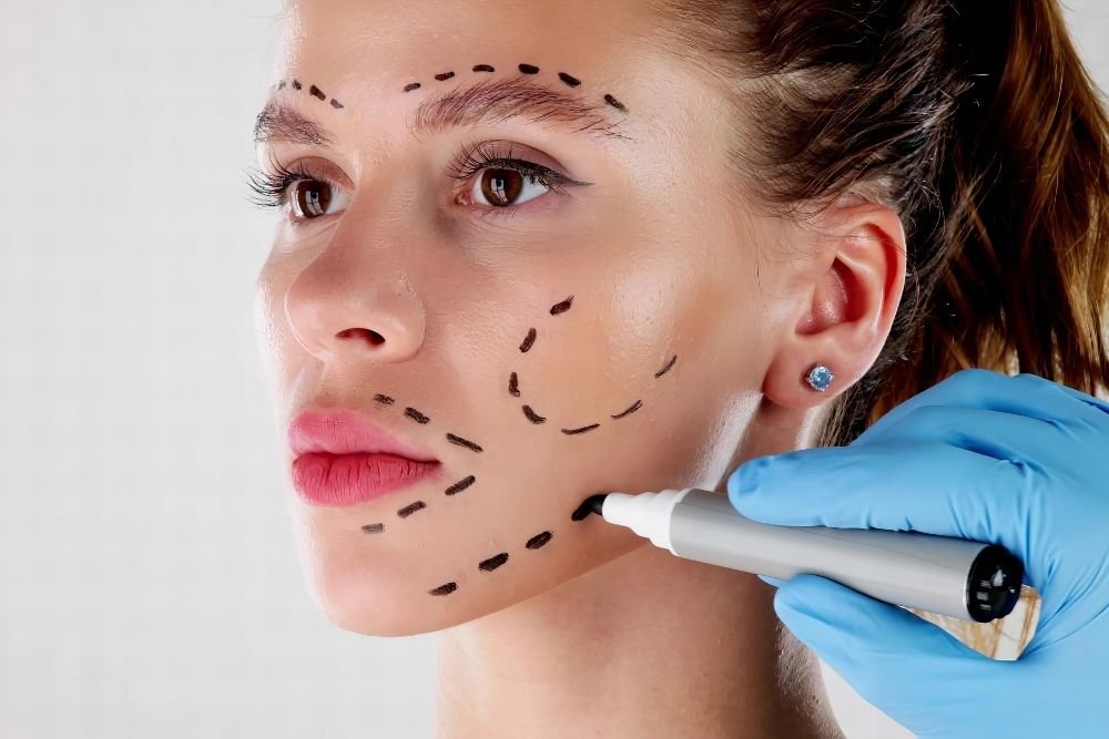 Is It Safe to Have a Facelift in Turkey?
