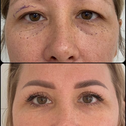 cateye-before-after